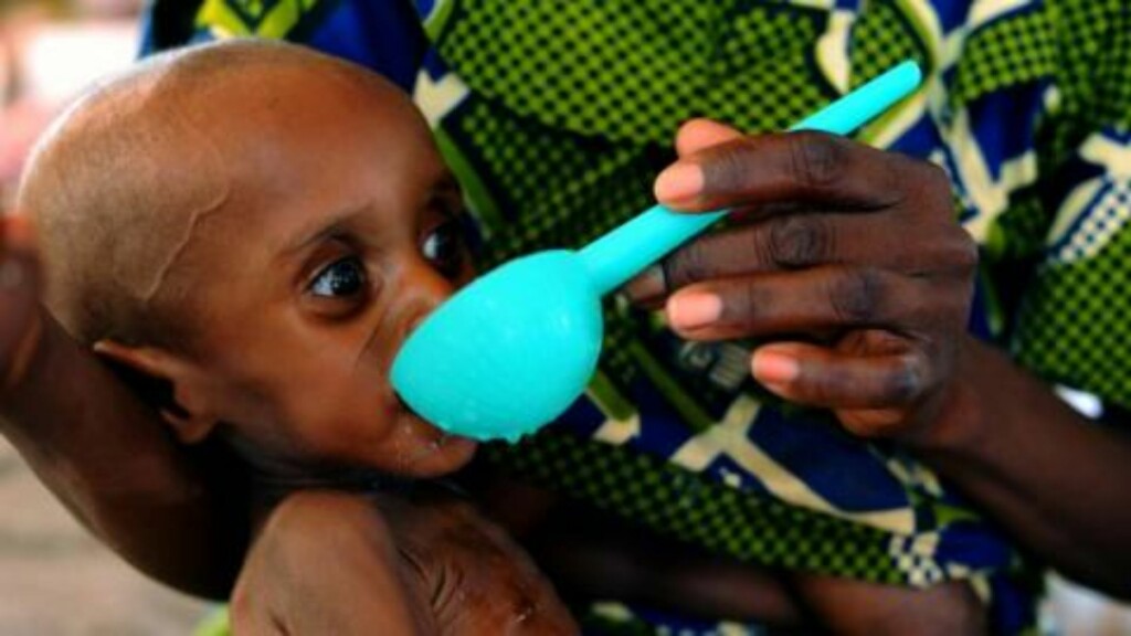Aicha gir mat til sin feilernærte sønn. Saminou er 8 måneder gammel og veier bare 4 kilo. I Norge regner man med at en frisk guttebaby på samme alder veier mellom 6,2 og 12 kilo. Niger er preget av ekstrem matvaremangel, delvis på grunn av klimaendringer. Foto: Redd Barna Aicha gir mat til sin feilernærte sønn. Saminou er 8 måneder gammel og veier bare 4 kilo. I Norge regner man med at en frisk guttebaby på samme alder veier mellom 6,2 og 12 kilo. Niger er preget av ekstrem matvaremangel, delvis på grunn av klimaendringer. Foto: Redd Barna