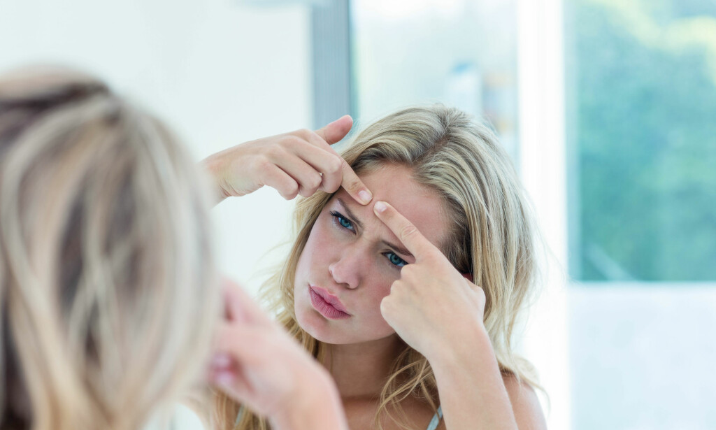 UREN HUD: Mindre kviser og uren hud er en bivirkningene p-piller kan gi og dermed kan dette komme tilbake når du slutter på p-pillene. FOTO: NTB Scanpix UREN HUD: Mindre kviser og uren hud er en bivirkningene p-piller kan gi og dermed kan dette komme tilbake når du slutter på p-pillene. FOTO: NTB Scanpix