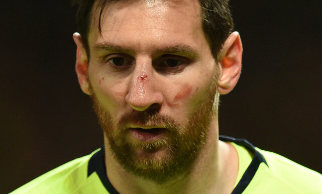 Foto: Oli SCARFF / AFP Foto: Oli SCARFF / AFP