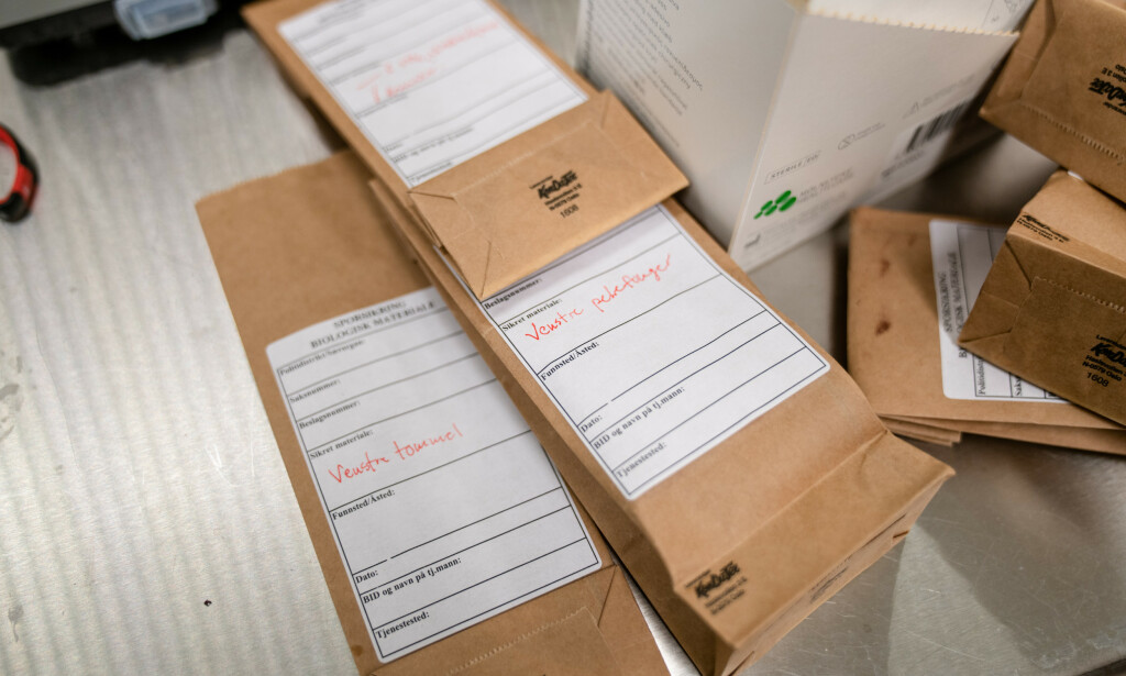 ANALYSE: Fingeravtrykk, DNA og røntgen av tennene sendes ti Kripos for videre undersøkelser. Foto: Øistein Norum Monsen / Dagbladet ANALYSE: Fingeravtrykk, DNA og røntgen av tennene sendes ti Kripos for videre undersøkelser. Foto: Øistein Norum Monsen / Dagbladet