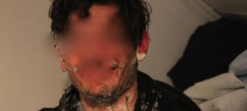 En russ ble satt fyr på, den andre dynket i byggskum: - Ikke det lureste de har gjort dette århundret En russ ble satt fyr på, den andre dynket i byggskum: - Ikke det lureste de har gjort dette århundret