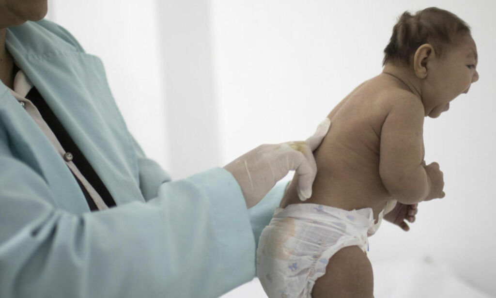 image: USA fastslår at zikavirus forårsaker fosterskader