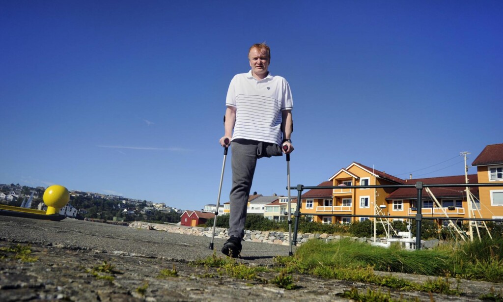 Måtte amputere: Morten Skarshaug måtte amputere hele venstre beienet etter en hissig infeksjon januar i år. For at han skulle vært dekket av forsikringen, måtte han fjernet f.eks. hånda også. – Det er sikkert mange forsikringstakere som ikke er klar over at de kan risikere å ikke få utbetalt noe som helst, sier han. Foto: Fridgeir Walderhaug Måtte amputere: Morten Skarshaug måtte amputere hele venstre beienet etter en hissig infeksjon januar i år. For at han skulle vært dekket av forsikringen, måtte han fjernet f.eks. hånda også. – Det er sikkert mange forsikringstakere som ikke er klar over at de kan risikere å ikke få utbetalt noe som helst, sier han. Foto: Fridgeir Walderhaug