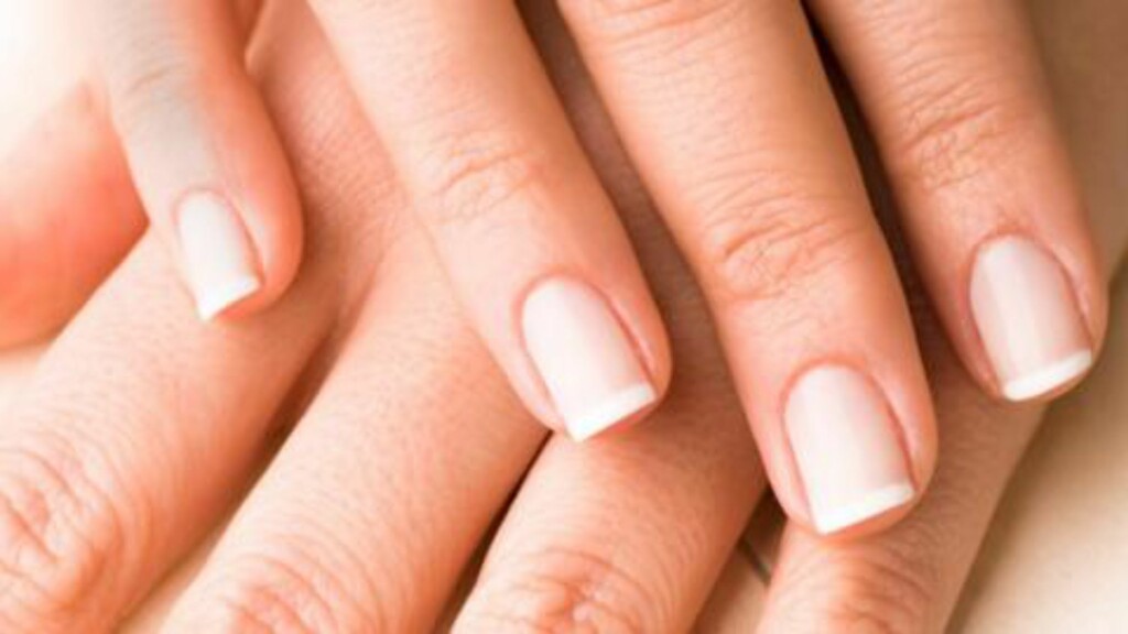 HVITE FLEKKER: Dette er skader på neglen og ikke kalkmangel slik en del tror. FOTO: Thinkstock HVITE FLEKKER: Dette er skader på neglen og ikke kalkmangel slik en del tror. FOTO: Thinkstock