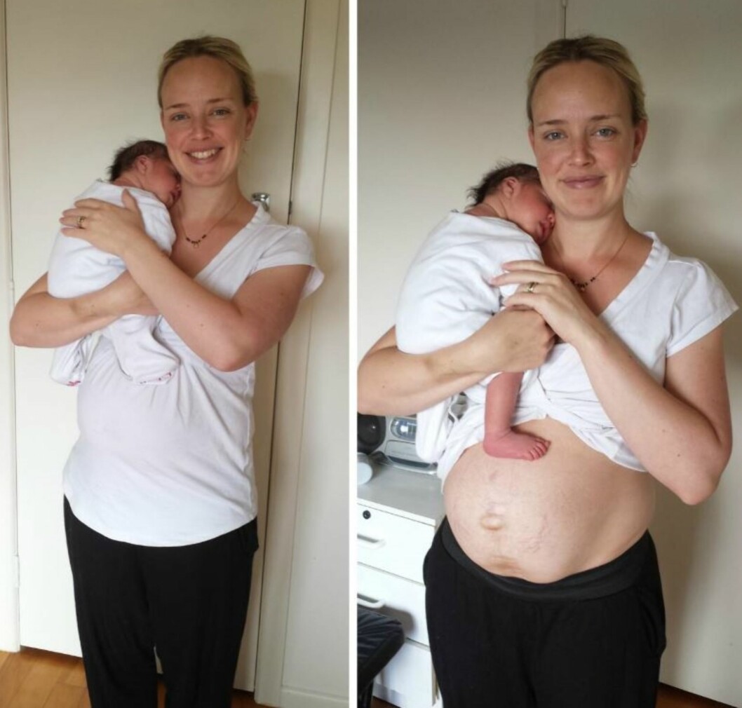 EN UKE ETTER FØDSELEN: Ikke alle skjønner at det kan ta tid før magen trekker seg sammen, sier Julie. Foto: Privat EN UKE ETTER FØDSELEN: Ikke alle skjønner at det kan ta tid før magen trekker seg sammen, sier Julie. Foto: Privat