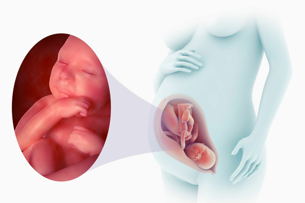 GRAVID UKE 39: Modell av graviditet i svangerskapsuke 39. Foto: Science Picture/NTB Scanpix GRAVID UKE 39: Modell av graviditet i svangerskapsuke 39. Foto: Science Picture/NTB Scanpix