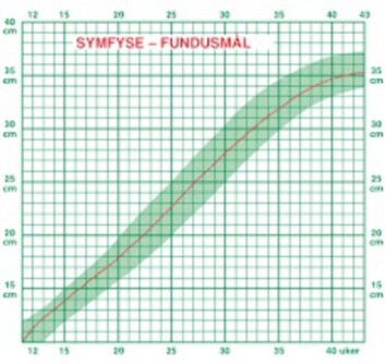 Maling 1000 oslo Maling 1000 oslo