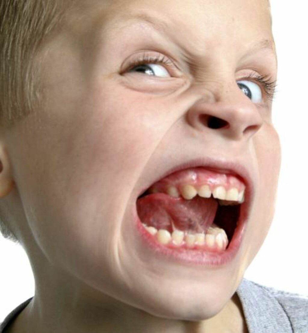 SYLKVASSE TENNER: Det gjør ikke bare vondt å bli bitt, det kan også føre til infeksjoner, og du kan trenge antibiotikabehandling. Foto: iStockphoto SYLKVASSE TENNER: Det gjør ikke bare vondt å bli bitt, det kan også føre til infeksjoner, og du kan trenge antibiotikabehandling. Foto: iStockphoto