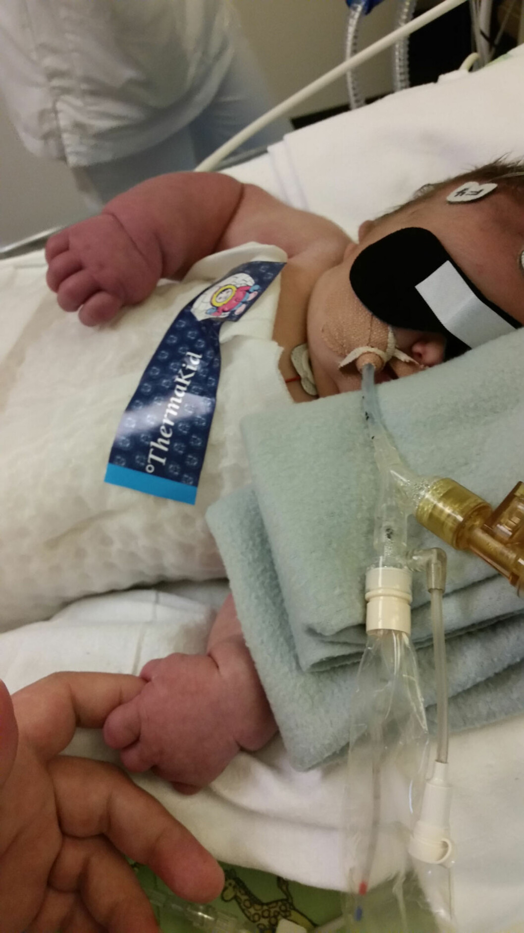 NEDKJØLT I 72 TIMER: Behandlingen Hedda Elise fikk på sykehuset kan ha redusert skadene etter oksygenmangelen ved fødselen. Foto: privat NEDKJØLT I 72 TIMER: Behandlingen Hedda Elise fikk på sykehuset kan ha redusert skadene etter oksygenmangelen ved fødselen. Foto: privat