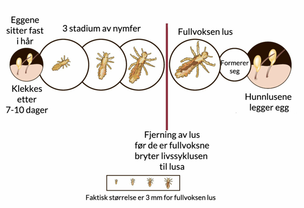 BRYT LIVSSYKLUSEN TIL LUSA: Behandle med lusekur TO GANGER med anbefalt mellomrom for å bli kvitt lusa for godt. Foto: Shutterstock © BRYT LIVSSYKLUSEN TIL LUSA: Behandle med lusekur TO GANGER med anbefalt mellomrom for å bli kvitt lusa for godt. Foto: Shutterstock ©