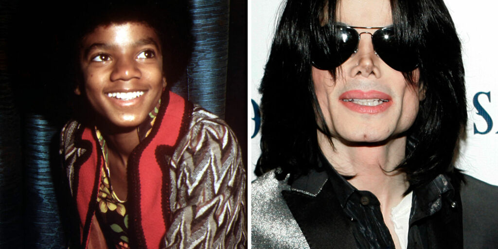 image: - Michael Jackson fikk sprøyter for å bevare sin lyse stemme
