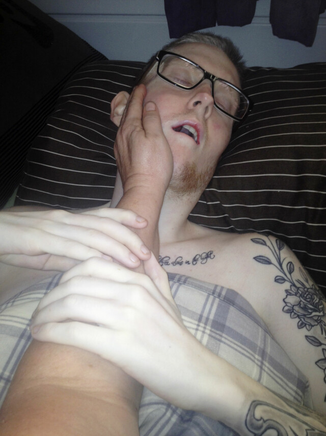 Klødde på føflekk begynte å blø Klødde på føflekk begynte å blø