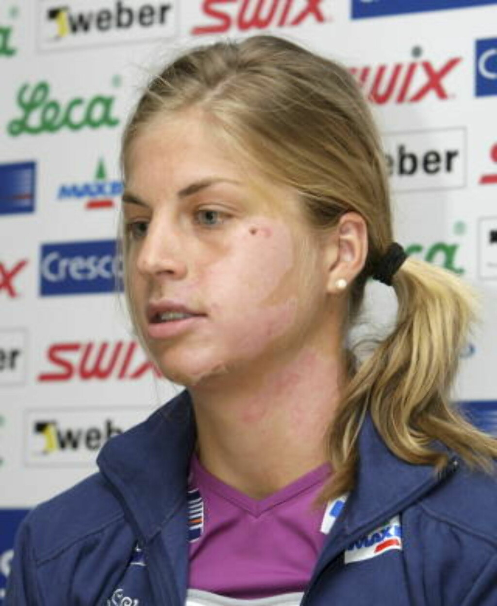 LANG VEI TILBAKE: OL var det siste Astrid Uhrenholdt Jacobsen tenkte på da hun møtte pressen i august, en stund etter at hun hadde skadet seg stygt på sykkelen.
Foto: Terje Bendiksby / SCANPIX . LANG VEI TILBAKE: OL var det siste Astrid Uhrenholdt Jacobsen tenkte på da hun møtte pressen i august, en stund etter at hun hadde skadet seg stygt på sykkelen.
Foto: Terje Bendiksby / SCANPIX .