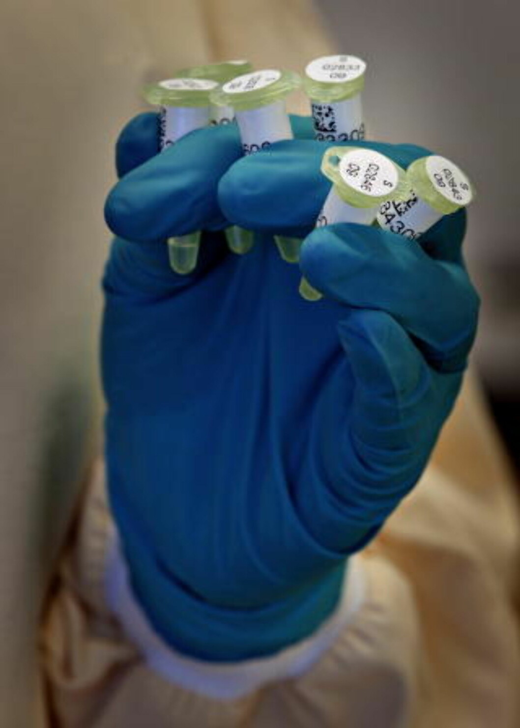 <strong>GJENFUNNET:</strong> Det var 199 slike reagensrør med DNA-materiale fra Baneheia-saken som RMI fant i en fryseboks, 10 måneder etter instituttets ledelse hevdet at materialet var destruert. Foto: Jørn H. Moen <strong>GJENFUNNET:</strong> Det var 199 slike reagensrør med DNA-materiale fra Baneheia-saken som RMI fant i en fryseboks, 10 måneder etter instituttets ledelse hevdet at materialet var destruert. Foto: Jørn H. Moen