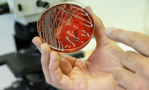image: WHO slår alarm: Multiresistente bakterier sprer seg på sykehus i Europa