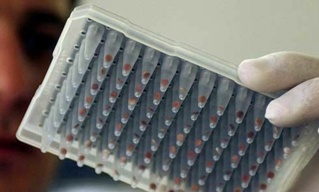BEST I VERDEN: Det bosniske DNA-laboratoriet ICMP tar over identifiseringen av døde fra Thailand. Foto: AP BEST I VERDEN: Det bosniske DNA-laboratoriet ICMP tar over identifiseringen av døde fra Thailand. Foto: AP