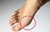 valgus være på kuler føttene Høye hælerHar hallux du fått kan Det XOuPikZ
