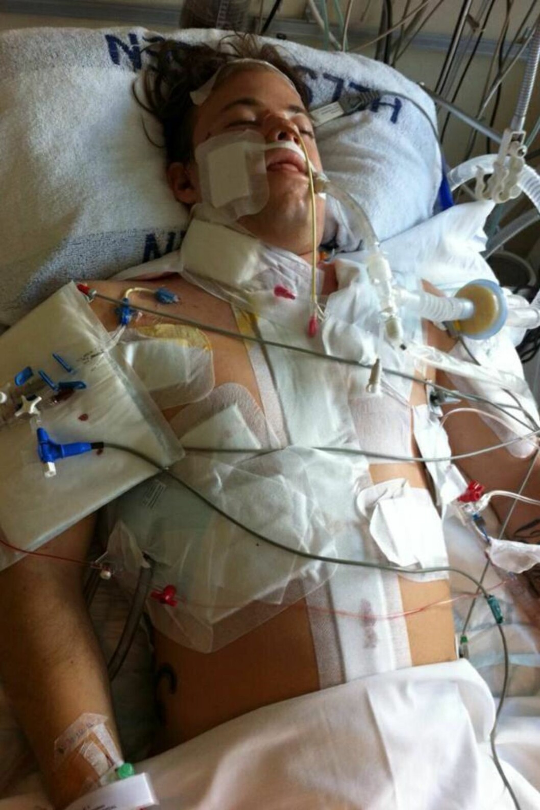 HARDT SKADET: Marius lå 11 dager i koma, og i løpet av behandlingstiden trengte han 30 liter blod etter nesten å ha blødd i hjel etter 20 knivstikk. Foto: Privat HARDT SKADET: Marius lå 11 dager i koma, og i løpet av behandlingstiden trengte han 30 liter blod etter nesten å ha blødd i hjel etter 20 knivstikk. Foto: Privat