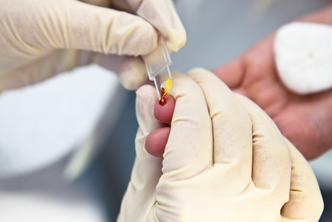 MANGE TILFELLER: Ved årsskiftet var det totalt 5371 personer som hadde fått påvist hiv i Norge. Foto: spflaum - Fotolia MANGE TILFELLER: Ved årsskiftet var det totalt 5371 personer som hadde fått påvist hiv i Norge. Foto: spflaum - Fotolia