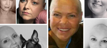 Kreftsyke norske kvinner kaster parykken på Facebook Kreftsyke norske kvinner kaster parykken på Facebook
