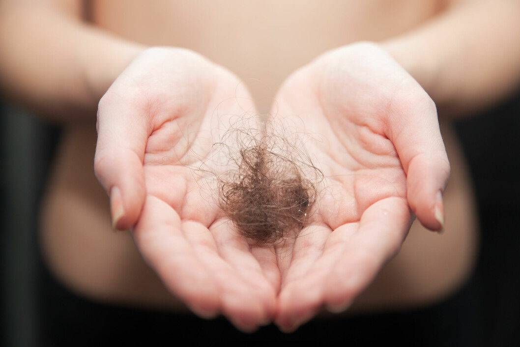 HAR DU FUNNET EN SLIK I SLUKET? Dersom du har et hår som gjennomsnittlig er 20 centimeter, og du mister rundt 150 hårstrå om dagen tilsvarer det rundt 30 meter med hår - om dagen! Foto: carol_anne - Fotolia HAR DU FUNNET EN SLIK I SLUKET? Dersom du har et hår som gjennomsnittlig er 20 centimeter, og du mister rundt 150 hårstrå om dagen tilsvarer det rundt 30 meter med hår - om dagen! Foto: carol_anne - Fotolia