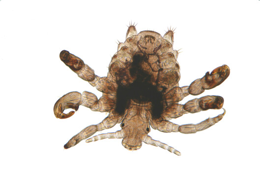 EKKEL LITEN KRABAT: Slik ser flatlusa ut.... Foto: Warren Rosenberg - Fotolia EKKEL LITEN KRABAT: Slik ser flatlusa ut.... Foto: Warren Rosenberg - Fotolia