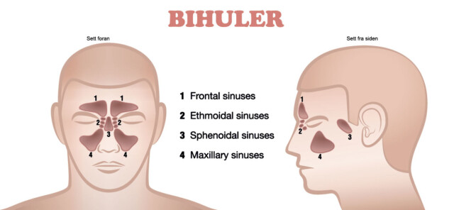 Vondt i bihulene uten forkjølelse Vondt i bihulene uten forkjølelse