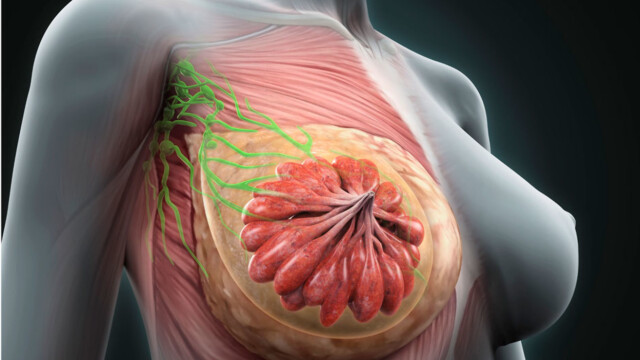 Livmorhalskreft arvelig Livmorhalskreft arvelig