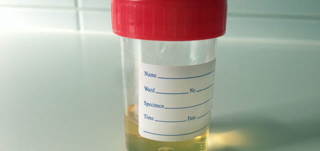 Glukose i urin gravid