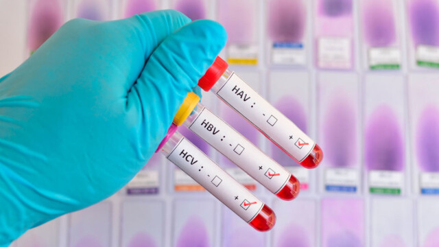 Hepatitt c inkubasjonstid Hepatitt c inkubasjonstid