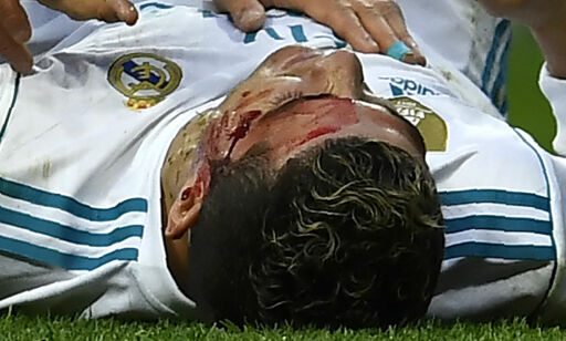 image: Ronaldo sparket til blods da Real Madrid knuste Deportivo