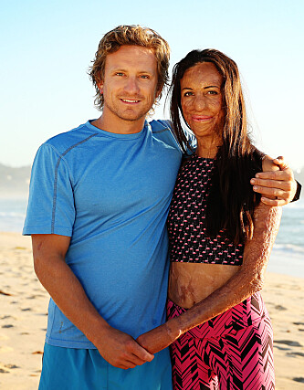 LYKKELIGE: Barndomsvennen og kjæresten Michael Hoskin har vært en enorm støtte for Turia Pitt. I 2015 forlovet de to seg, og i dag er de foreldre til sønnen Hakavai Hoskin. Foto: NTB Scanpix LYKKELIGE: Barndomsvennen og kjæresten Michael Hoskin har vært en enorm støtte for Turia Pitt. I 2015 forlovet de to seg, og i dag er de foreldre til sønnen Hakavai Hoskin. Foto: NTB Scanpix