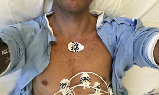 image: Hard trening over lengre tid øker risikoen for hjerteflimmer