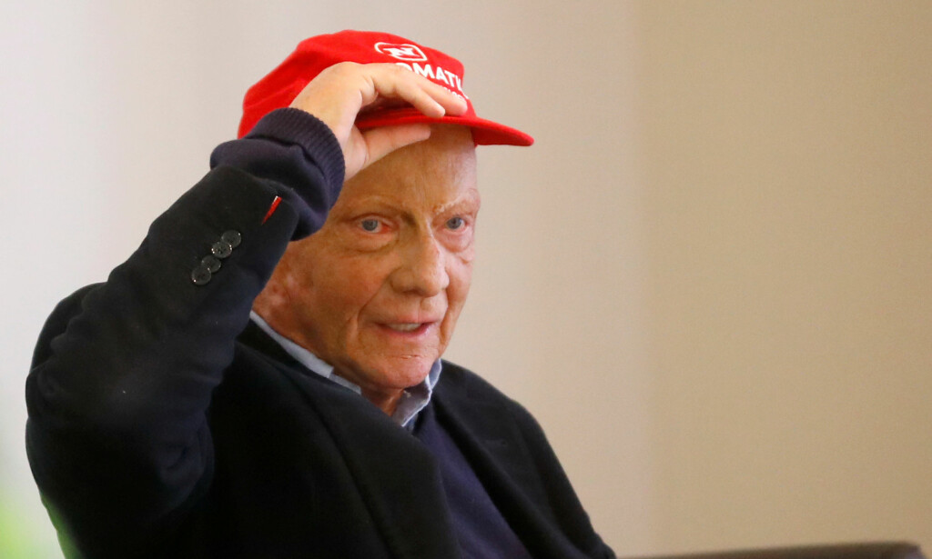TYDELIG MERKET: Niki Lauda bærer synlige arr etter den dramatiske ulykken for 42 år siden. I forrige uke fikk han en ny lunge. <br>Foto: Leonhard Foeger/REUTERS TYDELIG MERKET: Niki Lauda bærer synlige arr etter den dramatiske ulykken for 42 år siden. I forrige uke fikk han en ny lunge. <br>Foto: Leonhard Foeger/REUTERS
