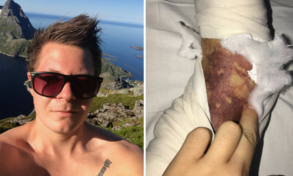 image: Christian (22) ble reddet fra samme fjell to dager på rad