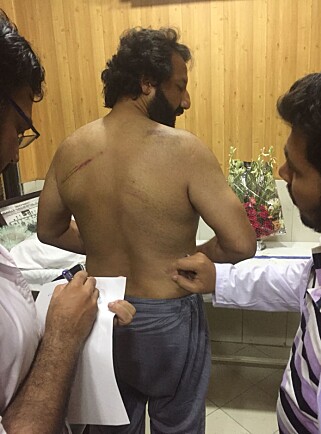 LEGESJEKK: Kadafi Zaman ble slått med stokker og har fått brist i ribbeina, flere blåmerker og hevelser på armene. Foto: Privat LEGESJEKK: Kadafi Zaman ble slått med stokker og har fått brist i ribbeina, flere blåmerker og hevelser på armene. Foto: Privat