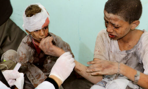 image: Flere titalls barn drept da skolebuss ble bombet i Jemen