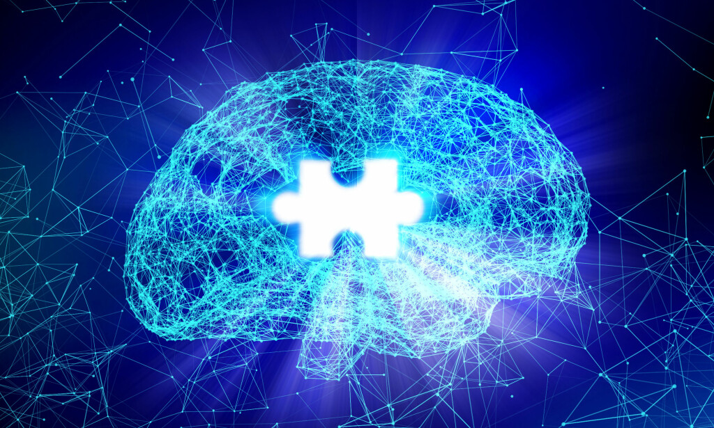 AVLAST HJERNEN: Forskere har vist endringer i hvordan hjernen prosesserer informasjon under stress. Når du er i en stressende situasjon, er hjernen satt i beredskap og angst og alarmsentralen i hjernen – amygdala – får mye energi. Det gjør at andre deler av hjernen, som hippocampus, som styrer korttidsminnet, får mindre energi. Foto: NTB / Scanpix AVLAST HJERNEN: Forskere har vist endringer i hvordan hjernen prosesserer informasjon under stress. Når du er i en stressende situasjon, er hjernen satt i beredskap og angst og alarmsentralen i hjernen – amygdala – får mye energi. Det gjør at andre deler av hjernen, som hippocampus, som styrer korttidsminnet, får mindre energi. Foto: NTB / Scanpix
