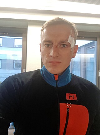 LEGEVISITT: Trygve Digre Berg (37) har tilbragt natta og morgenen hos legen, og fått konstatert et lite brudd på hodeskallen. - Bare en bulk i stålet, sier han selv. Foto: Privat LEGEVISITT: Trygve Digre Berg (37) har tilbragt natta og morgenen hos legen, og fått konstatert et lite brudd på hodeskallen. - Bare en bulk i stålet, sier han selv. Foto: Privat