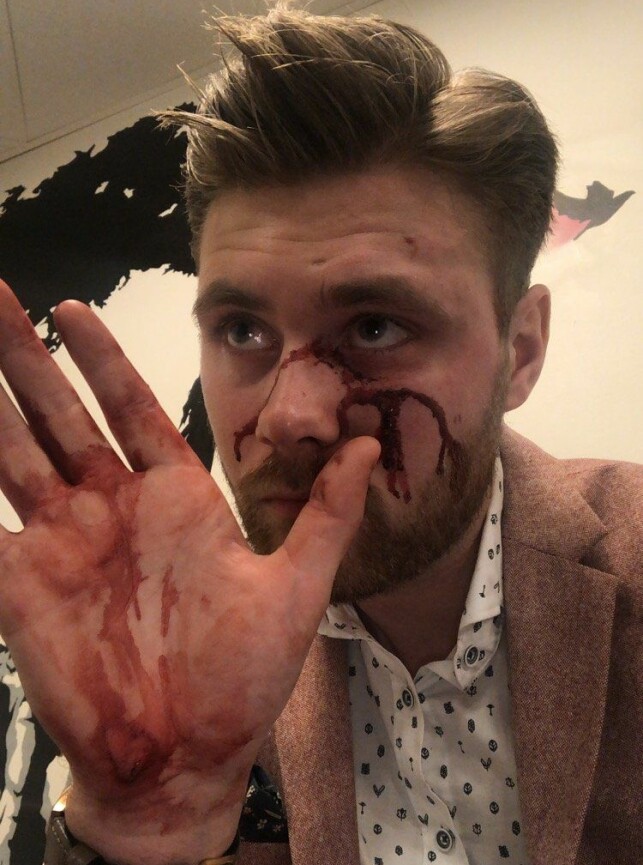 BLODIG: Marius tok flere bilder av seg selv etter hendelsen for å dokumentere skadene. - Ansiktet mitt var forslått og dressen min ble ødelagt, forteller han. Foto: Privat BLODIG: Marius tok flere bilder av seg selv etter hendelsen for å dokumentere skadene. - Ansiktet mitt var forslått og dressen min ble ødelagt, forteller han. Foto: Privat