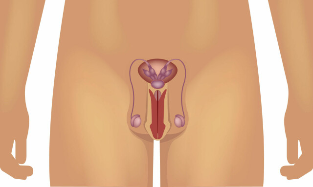 Forstørret prostata ereksjon