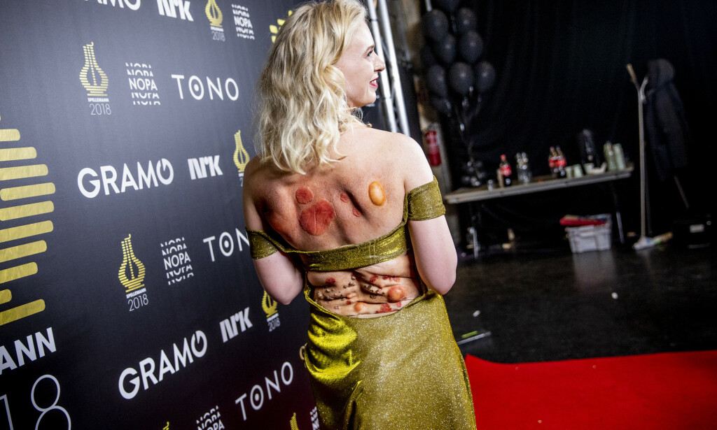 KOSTYME: Thea Hjelmeland vant pris for Indie og stilte i et spennende antrekk og sminke på ryggen. Foto: Christian Roth Christensen / Dagbladet KOSTYME: Thea Hjelmeland vant pris for Indie og stilte i et spennende antrekk og sminke på ryggen. Foto: Christian Roth Christensen / Dagbladet