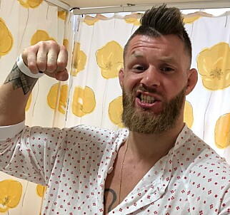 NYOPERERT: Emil Meek tok dette bildet av seg selv på sykehuset, like etter operasjonen. NYOPERERT: Emil Meek tok dette bildet av seg selv på sykehuset, like etter operasjonen.