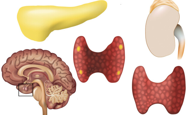 Hormonforstyrrelser symptomer Hormonforstyrrelser symptomer