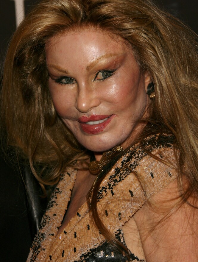 VERDENSKJENT: Jocelyn Wildenstein fikk med seg milliarder da hun skilte seg i 1999. Nå er hun kanskje mest kjent for sitt karakteristiske utseende. Foto: NTB scanpix VERDENSKJENT: Jocelyn Wildenstein fikk med seg milliarder da hun skilte seg i 1999. Nå er hun kanskje mest kjent for sitt karakteristiske utseende. Foto: NTB scanpix
