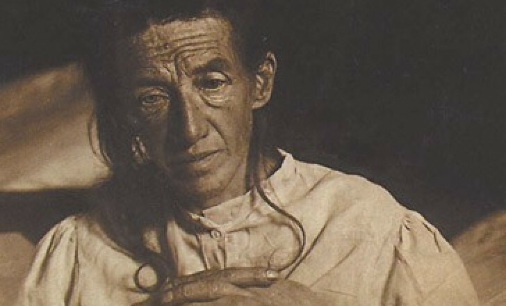 Auguste Deter, the first recorded case of Alzheimer’s Auguste Deter, the first recorded case of Alzheimer’s
