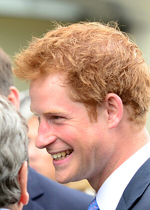 2011: Her er prins Harry avbildet i 2011 og man kan tydelig se at håret var tykkere den gang. Foto: NTB Scanpix 2011: Her er prins Harry avbildet i 2011 og man kan tydelig se at håret var tykkere den gang. Foto: NTB Scanpix