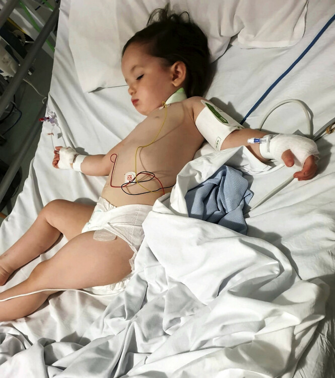 UTSLÅTT: Her er Elsie-Rose rett etter operasjonen. Hun lå på intensivavdelingen i fem døgn. Foto: NTB Scanpix UTSLÅTT: Her er Elsie-Rose rett etter operasjonen. Hun lå på intensivavdelingen i fem døgn. Foto: NTB Scanpix