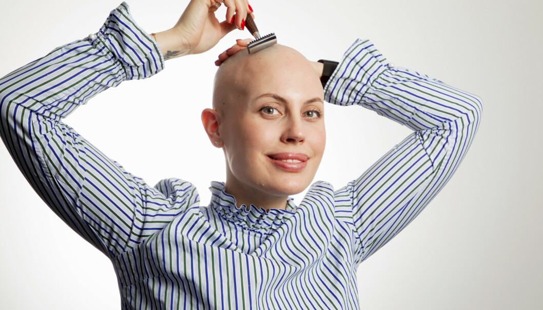 FJERNER TUSTENE: Sykdommen Alopecia Areata gjør Julia Viita hårløs. Hårtuster som flekkvis dukker opp fjerner hun regelmessig med barberhøvelen. Foto: Svend Aage Madsen/ Se og Hør FJERNER TUSTENE: Sykdommen Alopecia Areata gjør Julia Viita hårløs. Hårtuster som flekkvis dukker opp fjerner hun regelmessig med barberhøvelen. Foto: Svend Aage Madsen/ Se og Hør