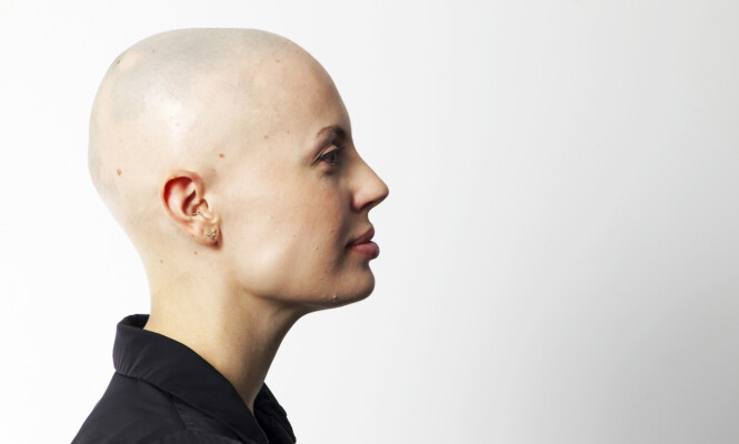 PARYKKER: Julia har mange forskjellige parykker, og hun trenger flere nye hvert eneste år. Foto: Svend Aage Madsen/ Se og Hør PARYKKER: Julia har mange forskjellige parykker, og hun trenger flere nye hvert eneste år. Foto: Svend Aage Madsen/ Se og Hør